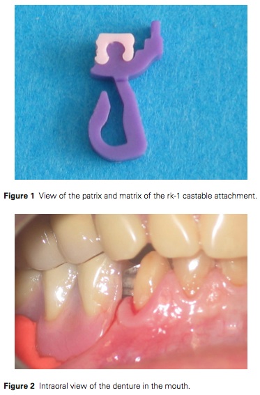 J Prosthodontics 2015 Vol.24-2
