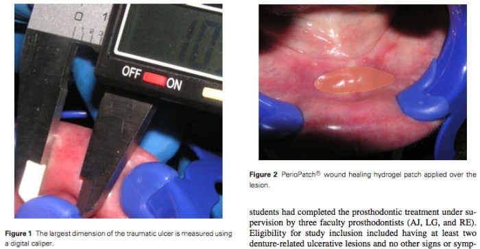 J Prosthodontics 2015 Vol.24-2