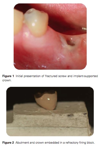 J Prosthodontics 2015 Vol.24-2