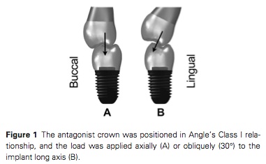 J Prosthodontics 2015 Vol.24-2
