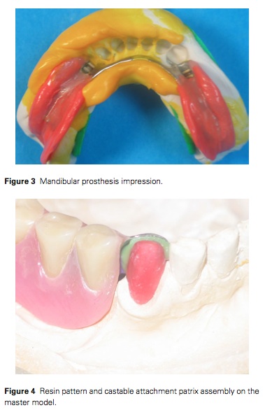 J Prosthodontics 2015 Vol.24-3