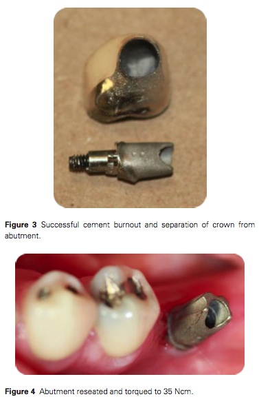 J Prosthodontics 2015 Vol.24-3