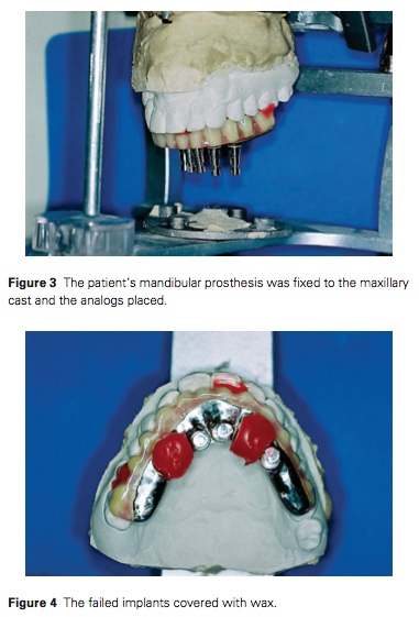 J Prosthodontics 2015 Vol.24-3