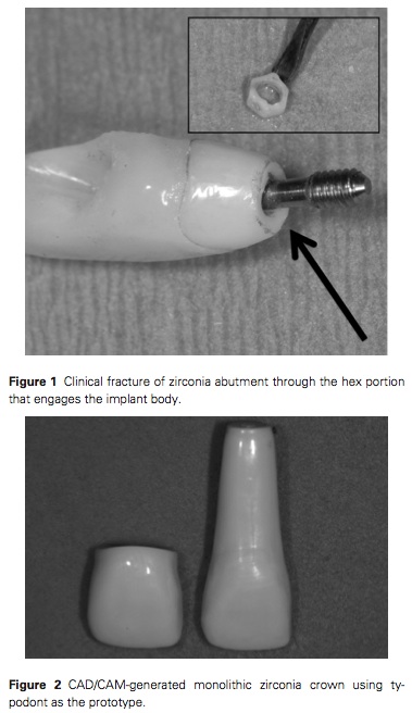 J Prosthodontics 2015 Vol.24-3
