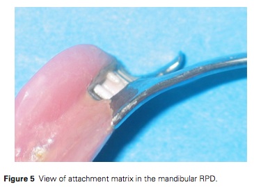 J Prosthodontics 2015 Vol.24-4