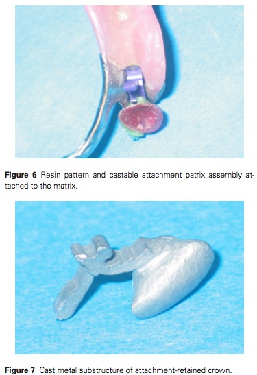 J Prosthodontics 2015 Vol.24-5