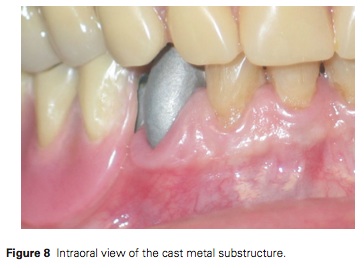 J Prosthodontics 2015 Vol.24-6