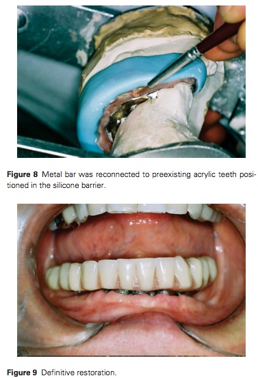J Prosthodontics 2015 Vol.24-6