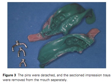 J Prosthodontics 2015 Vol.24-3
