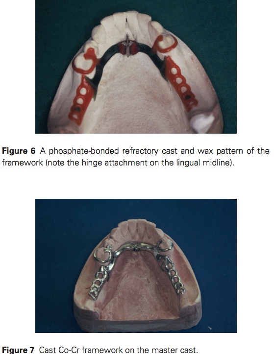 J prosthodontics 2015 Vol.24-5
