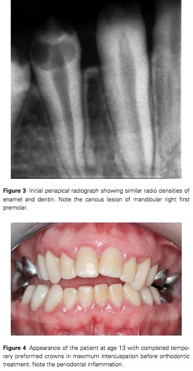 J Prosthodontics 2015 Vol.24-3