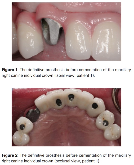 J Prosthodontics 2015 Vol.24-2