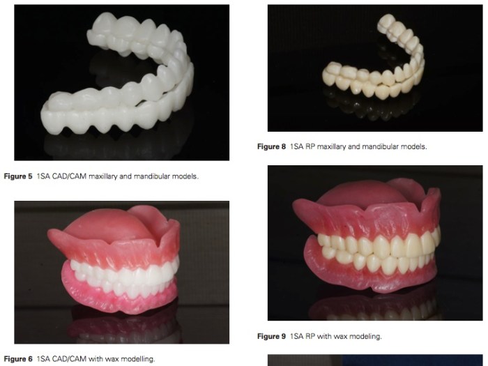 J Prosthodontics 2015 Vol.24-3