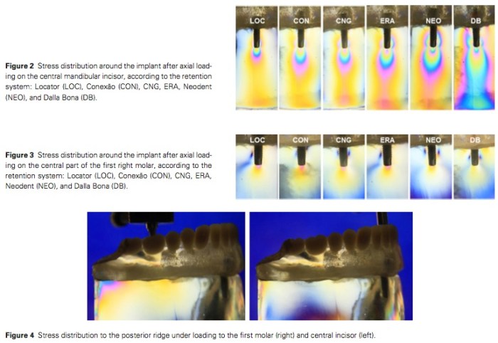 J Prosthodontics 2015 Vol.24-4