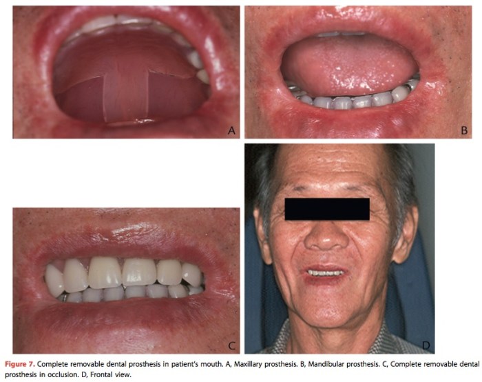 JPD 2015 Vol.114-8.jpg