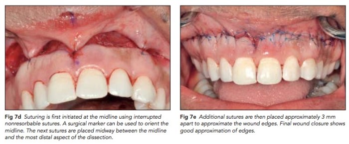 IJPRD 2015 Vol.35-10