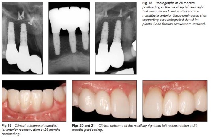 IJPRD 2015 Vol.35-5.jpg