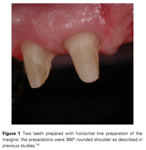 J Prosthodontics 2015 Vol.24-2