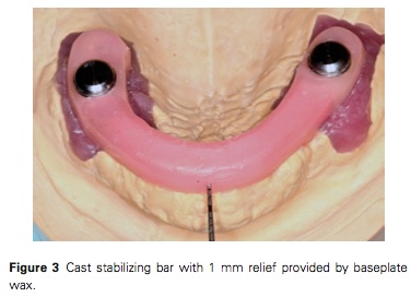 J prosthodontics 2015 Vol.24-3