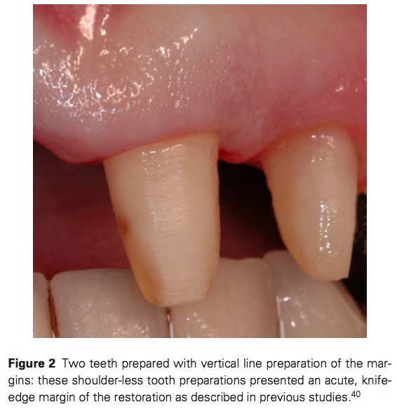 J Prosthodontics 2015 Vol.24-3