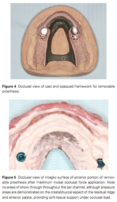J Prosthodontics 2015 Vol.24-4