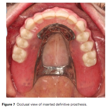 J prosthodontics 2015 Vol.24-6