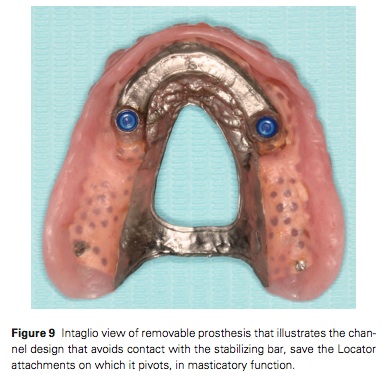 J Prosthodontics 2015 Vol.24-8
