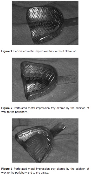 J Prosthodontics 2016 Vol.25-2