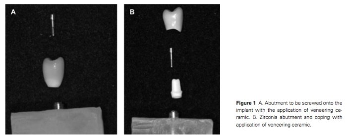 J Prosthodontics 2016 Vol.25-2