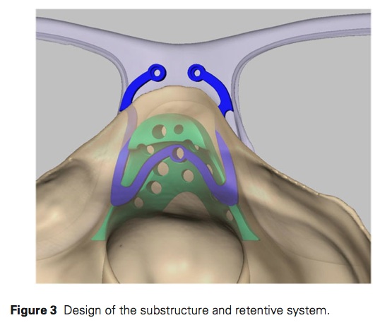 J prosthodontics 2016 Vol.25-3