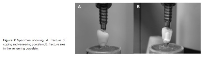 J Prosthodontics 2016 Vol.25-3