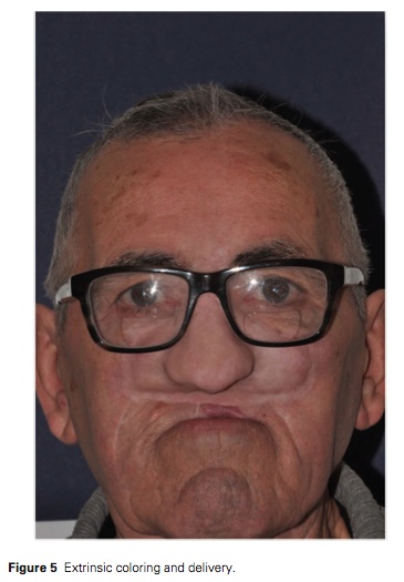 J Prosthodontics 2016 Vol.25-5