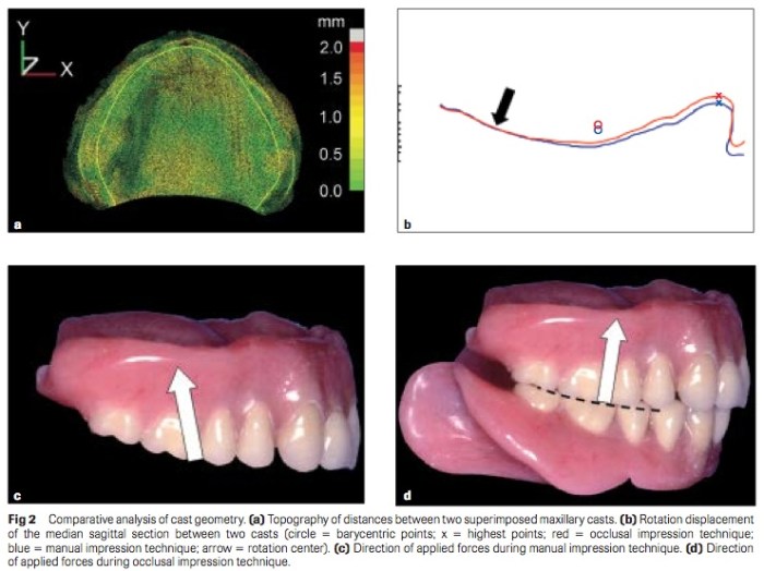 Int J Prosthodont 2016 Vol.29-3