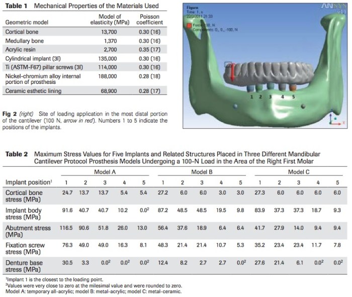 Int J Prosthodontics 2016 Vol.29-3