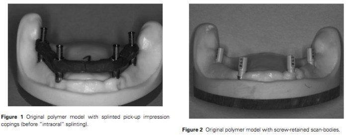 J Prosthodontics 2016 Vol.25-2