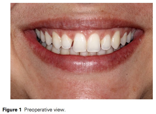 J Prosthodontics 2016 Vol.25-2