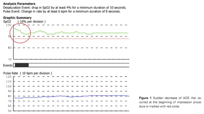 J Prosthodontics 2016 Vol.25-2