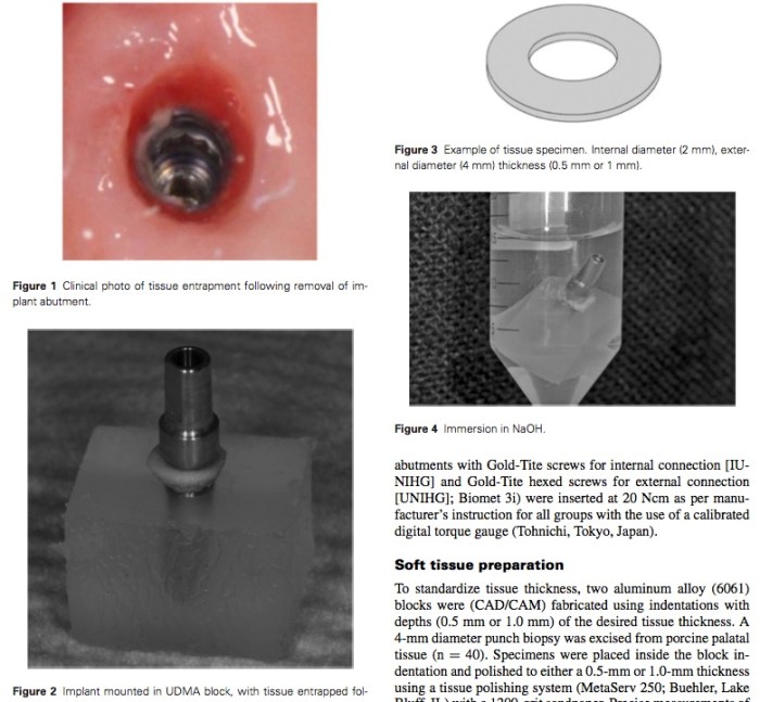 J Prosthodontics 2016 Vol.25-2