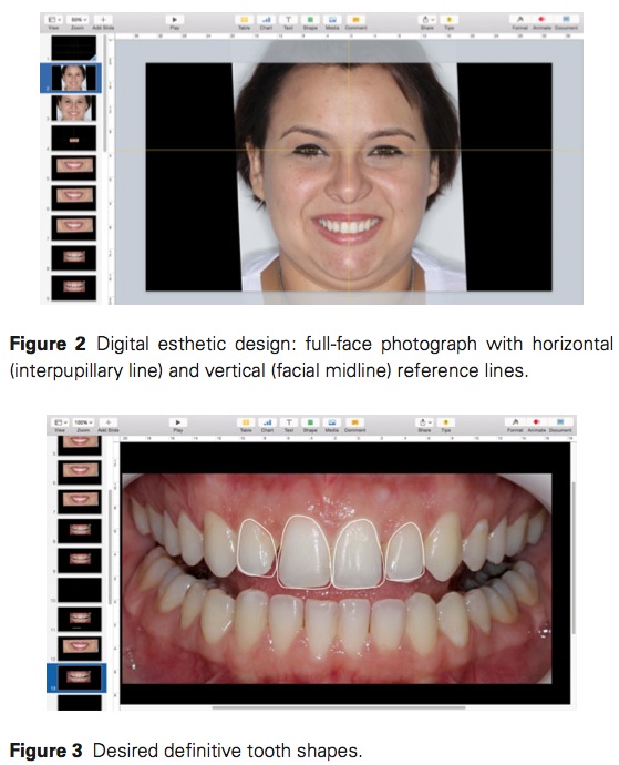 J Prosthodontics 2016 Vol.25-3