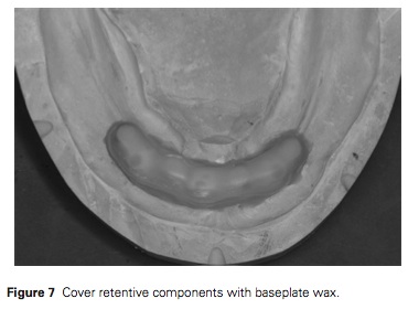 J Prosthodontics 2016 Vol.25-4