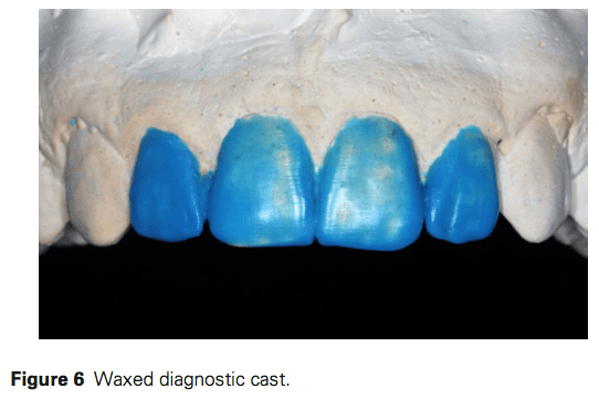 J Prosthodontics 2016 Vol.25-5