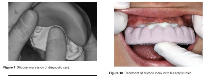 J Prosthodontics 2016 Vol.25-6