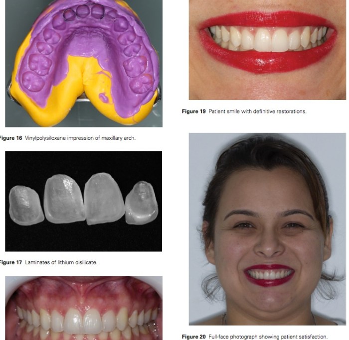 J Prosthodontics 2016 Vol.25-8