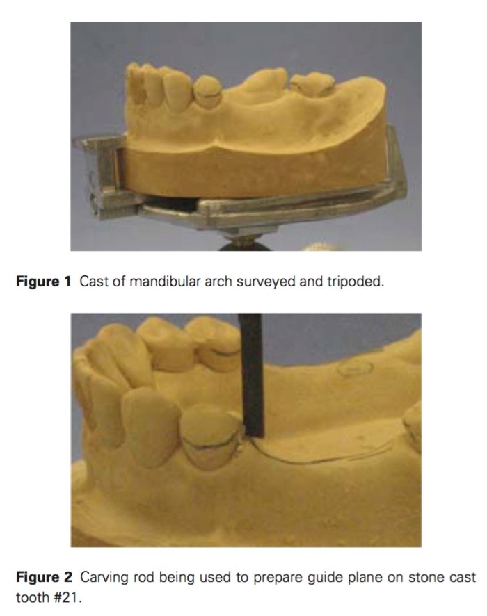 j-prosthodontics-2016-vol-25-2