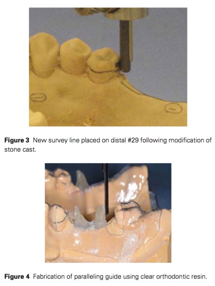 j-prosthodontics-2016-vol-25-3