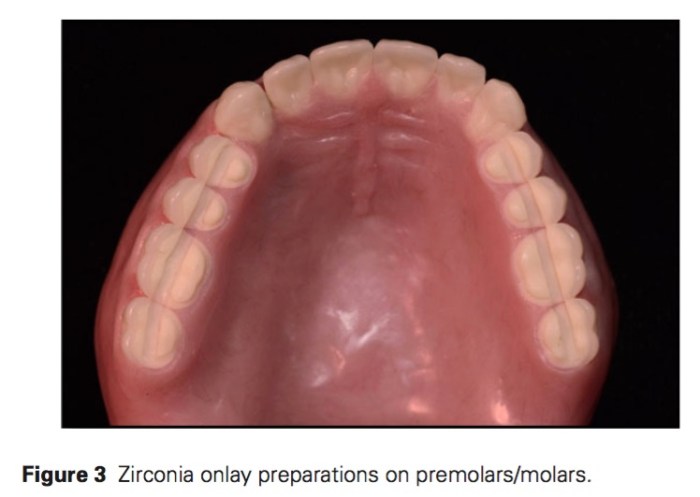 j-prosthodontics-2016-vol-25-3