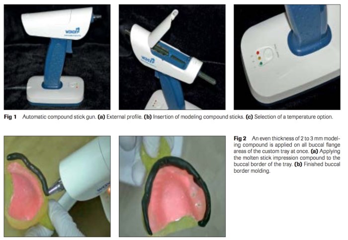 int-j-prosthodont-2016-vol-29-2