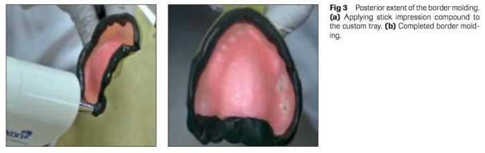 int-j-prosthodont-2016-vol-29-3