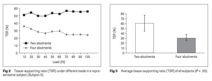 Int J Prosthodont 2017 Vol.30-3