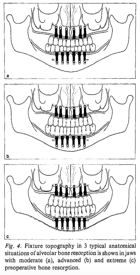 Int J Oral Surg 1981 Vol.10-5